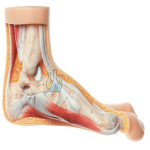 Model of the Hallux Valgus
